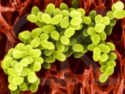 Fig. 1: Grape-like cluster of Staphylococcal aureus
